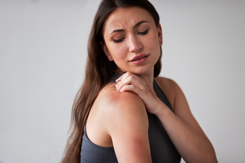 La dermatitis atópica impacta el bienestar social y  emocional de quienes la padecen