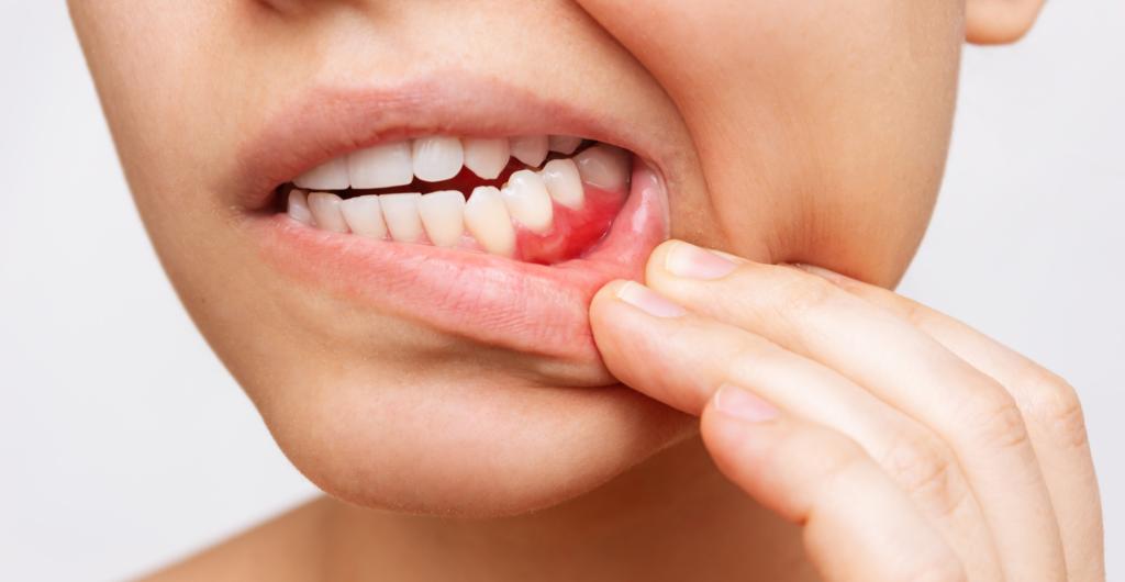 ¿De qué tonalidad deben estar mis dientes para ser considerados sanos?