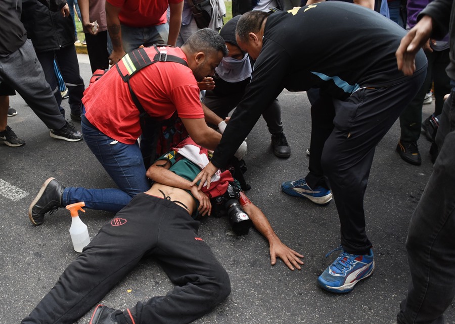 argentina-fotografo2 El fotógrafo Pablo Grillo, herido de gravedad durante una manifestación, el 13 de marzo de 2023, en Buenos Aires (Argentina). EFE/ Str