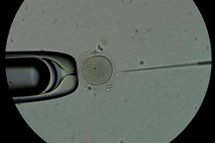 fecundacion-in-vitro Confusión de embriones en una clínica de Australia